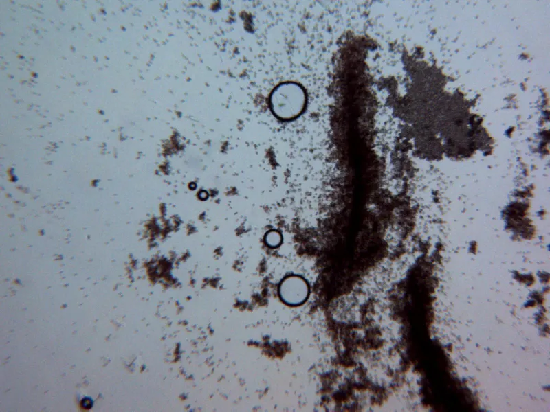 Cephalotrichum microsporum 12 - X 100